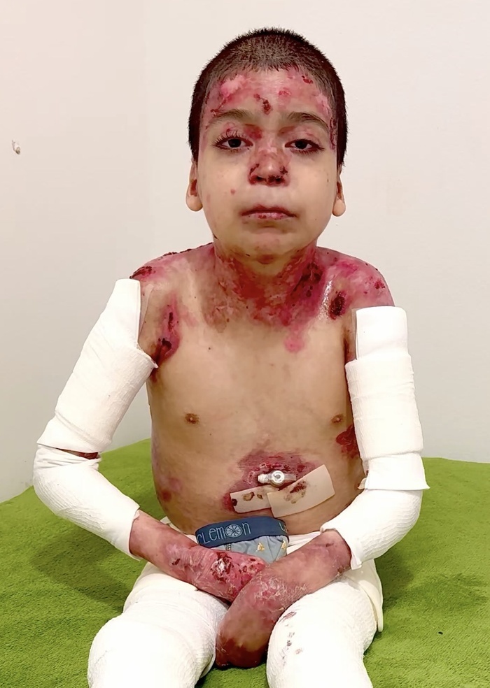 Jesus sitting during medical treatment