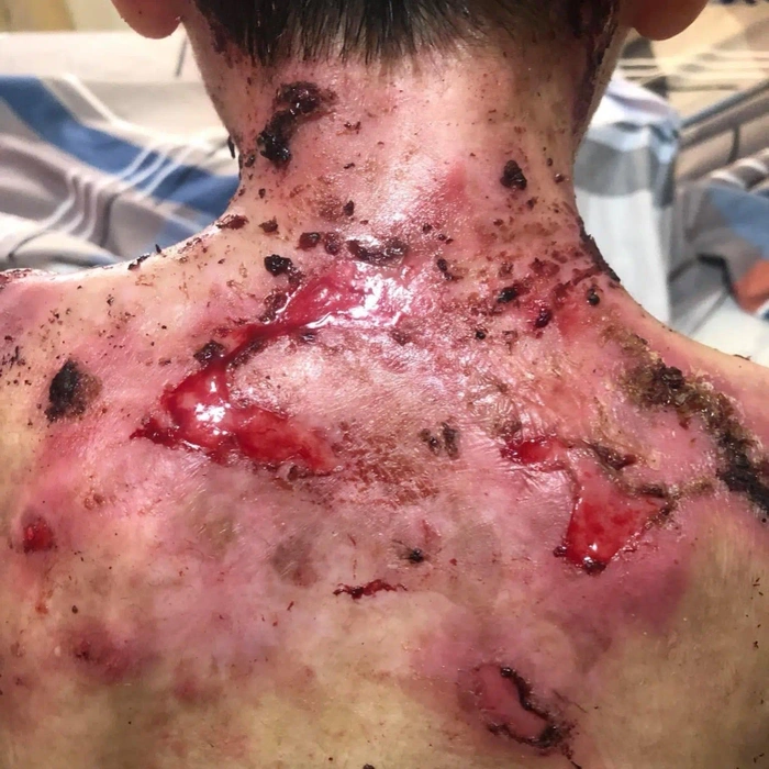 Close view of wounds on Jesus' back during treatment